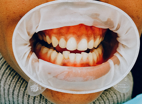Dental Blog 7